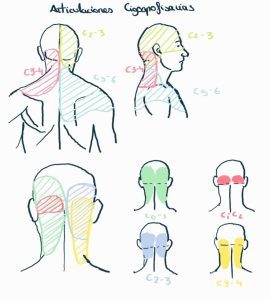 Zonas de dolor cervical